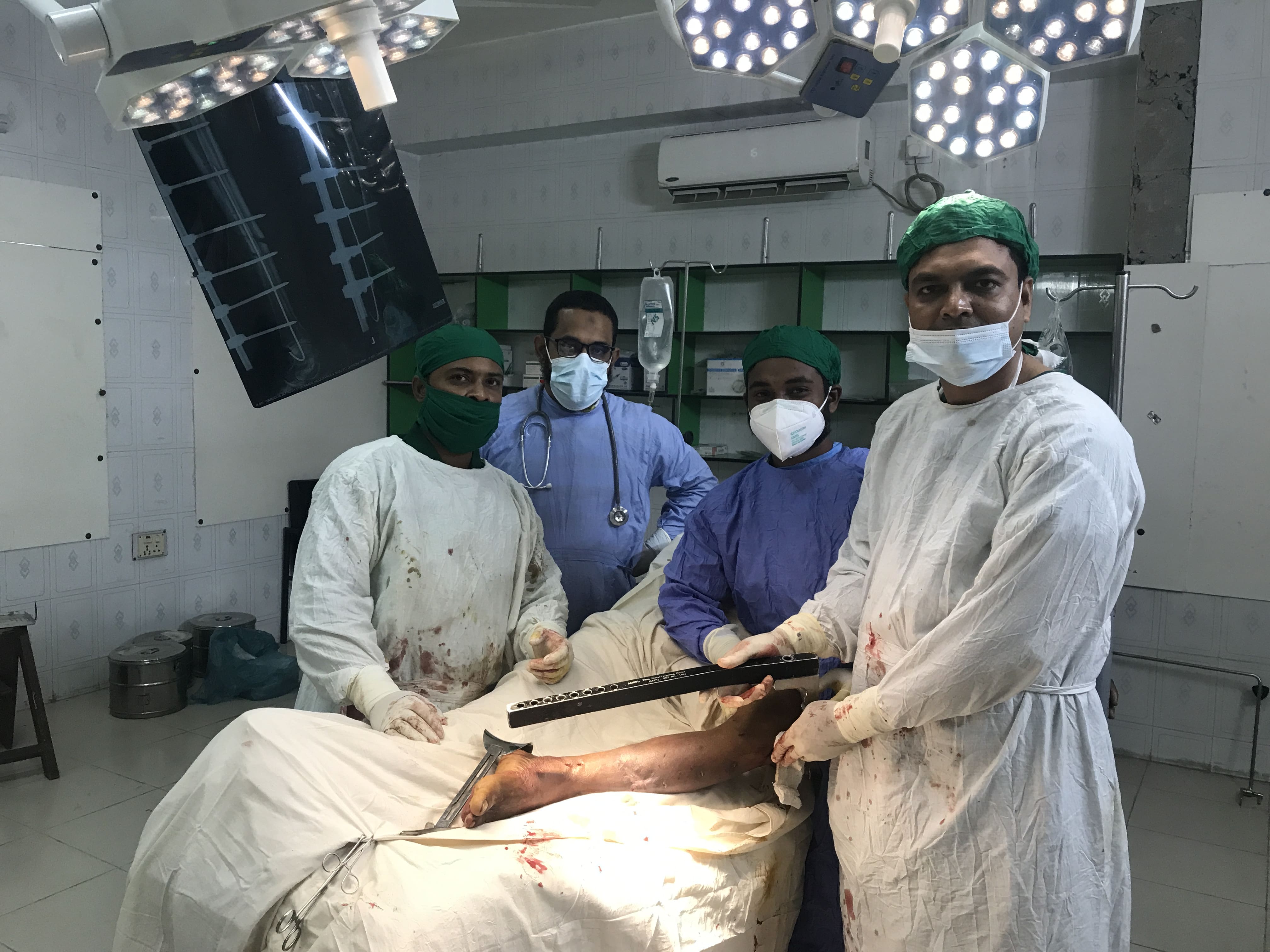 ঘোড়াঘাটে প্রথমবারের মতো উপজেলা পর্যায়ে অর্থোপেডিক অপারেশন সম্পন্ন